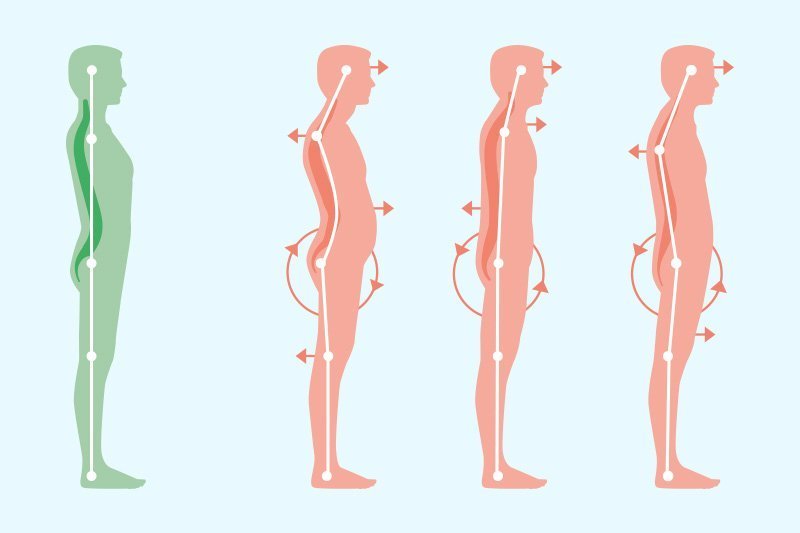 Standing Posture Ormond Physiotherapy